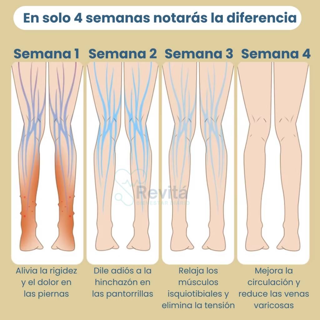 Masajeador de Piernas Hinchadas - SmartLeg